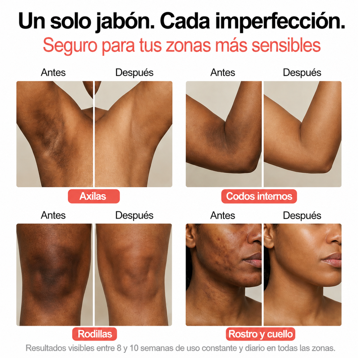 Barra Anti Acné Fórmula con Vitamina C, Alfa-Arbutina y Cúrcuma